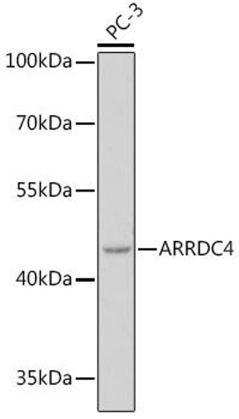 Anti-ARRDC4 Antibody (CAB18522)