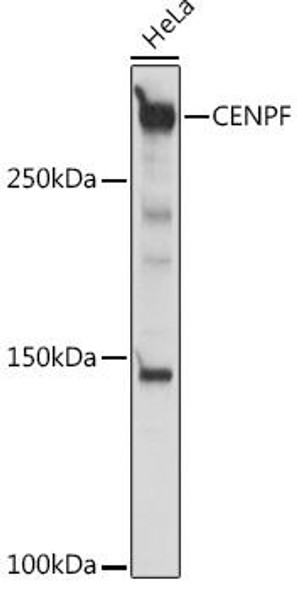 Anti-CENPF Antibody (CAB18644)