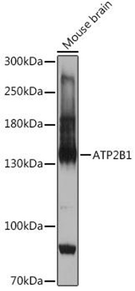 Anti-ATP2B1 Antibody (CAB18688)
