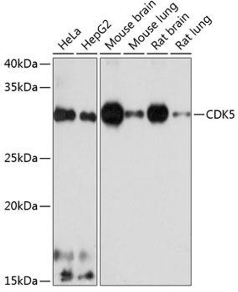 Anti-CDK5 Antibody (CAB19029)