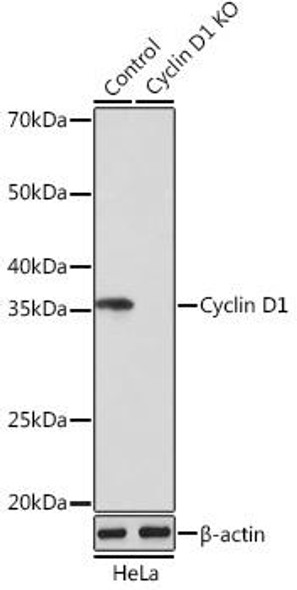 Anti-Cyclin D1 Antibody [KO Validated] (CAB19038)