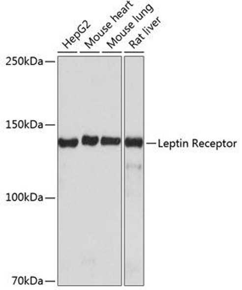 Anti-Leptin Receptor Antibody (CAB19076)