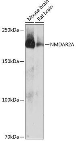 Anti-NMDAR2A Antibody (CAB19089)