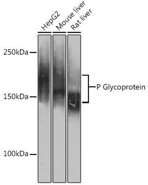 Anti-P Glycoprotein Antibody (CAB19093)