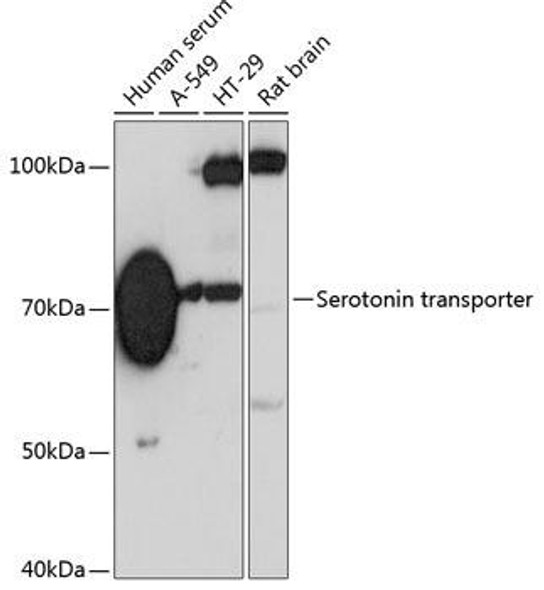 Anti-Serotonin transporter Antibody (CAB19110)