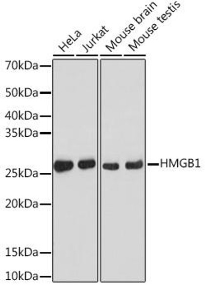 Anti-HMGB1 Antibody [KO Validated] (CAB19529)