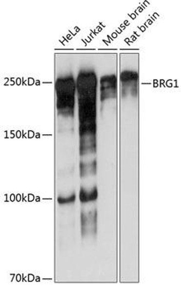 Anti-BRG1 Antibody (CAB19556)