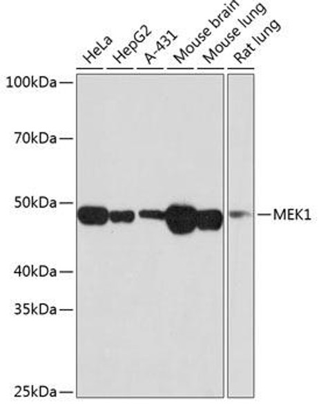 Anti-MEK1 Antibody (CAB19565)