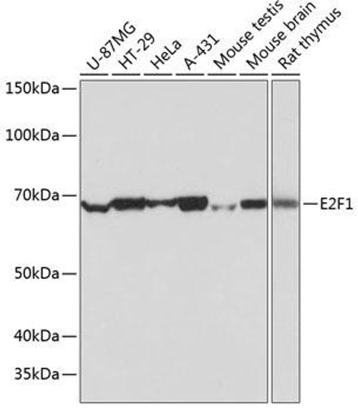 Anti-E2F1 Antibody (CAB19579)