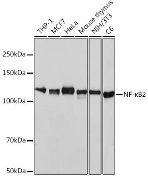 Anti-NF-kB2 Antibody (CAB19605)