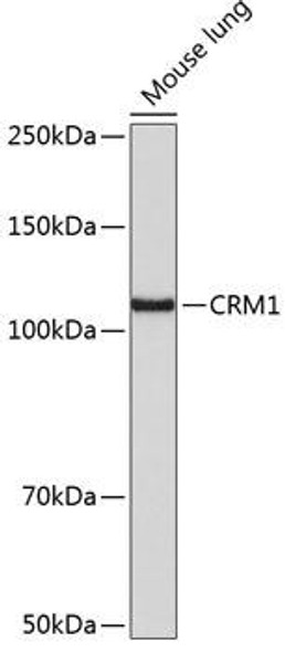 Anti-CRM1 Antibody (CAB19625)