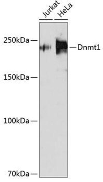 Anti-Dnmt1 Antibody [KO Validated] (CAB19679)