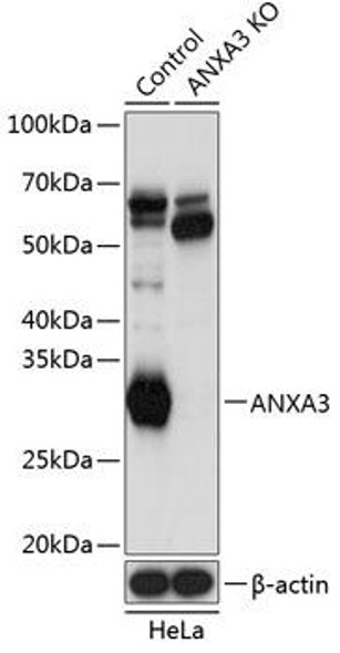 Anti-ANXA3 Antibody (CAB19861)[KO Validated]