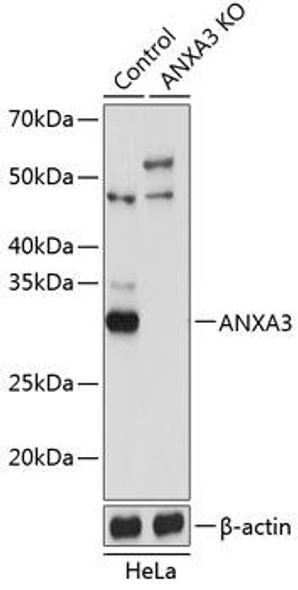 Anti-ANXA3 Antibody (CAB19862)[KO Validated]
