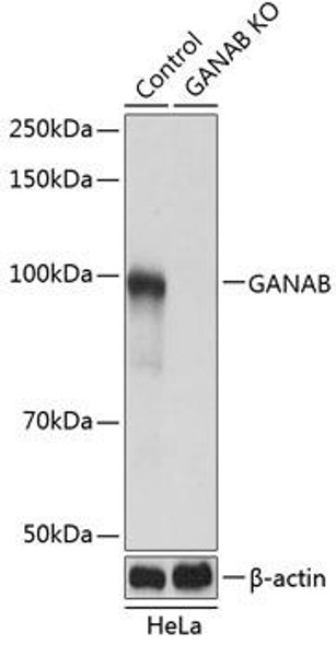 Anti-GANAB Antibody (CAB19876)[KO Validated]