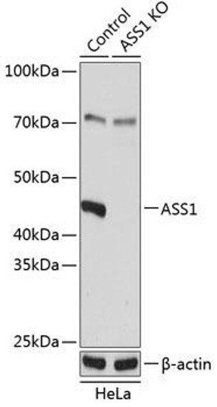 Anti-ASS1 Antibody (CAB19878)[KO Validated]