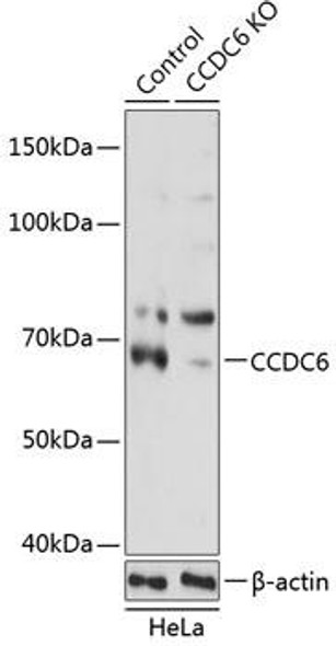 Anti-CCDC6 Antibody (CAB19901)[KO Validated]