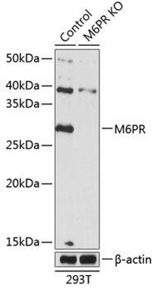 Anti-M6PR Antibody (CAB19907)[KO Validated]