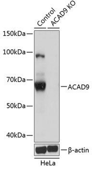 Anti-ACAD9 Antibody (CAB19942)[KO Validated]