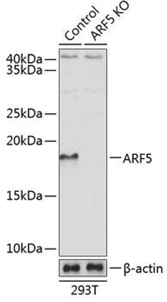 Anti-ARF5 Antibody (CAB19986)[KO Validated]