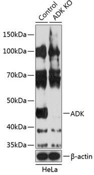 Anti-ADK Antibody (CAB19992)[KO Validated]