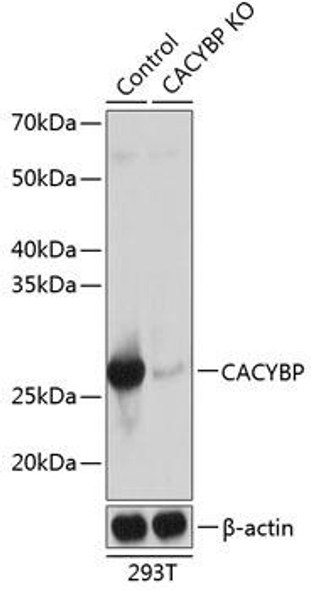 Anti-CACYBP Antibody (CAB20004)[KO Validated]