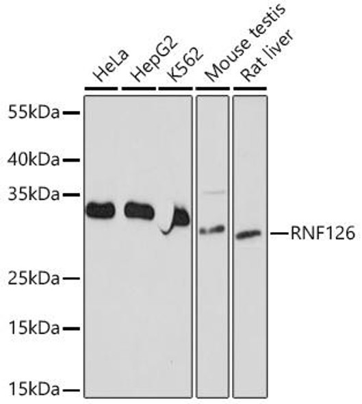 Anti-RNF126 Antibody (CAB20015)