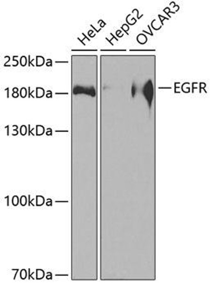 Anti-EGFR Antibody (CAB2909)