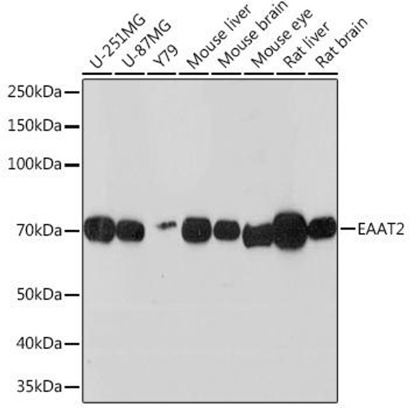 Anti-EAAT2 Antibody (CAB3679)