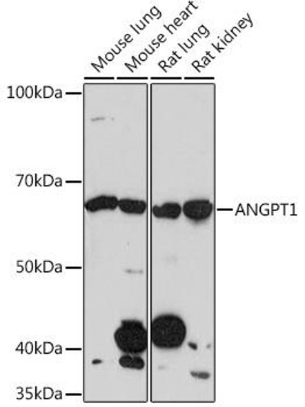 Anti-ANGPT1 Antibody (CAB3757)