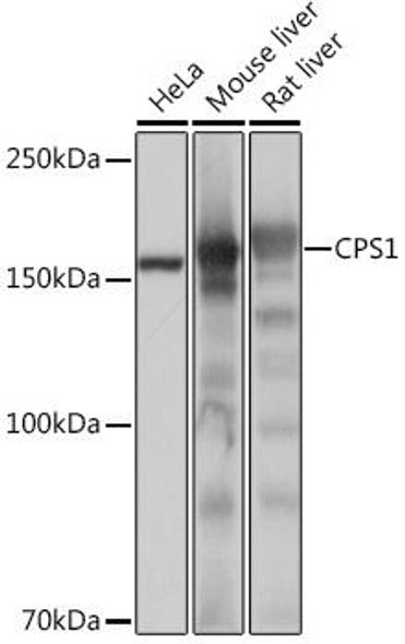 Anti-CPS1 Antibody (CAB4214)