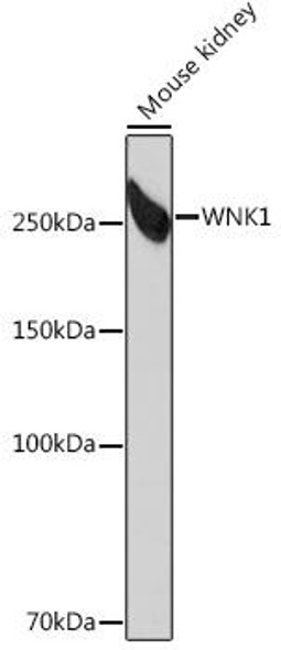 Anti-WNK1 Antibody (CAB4223)