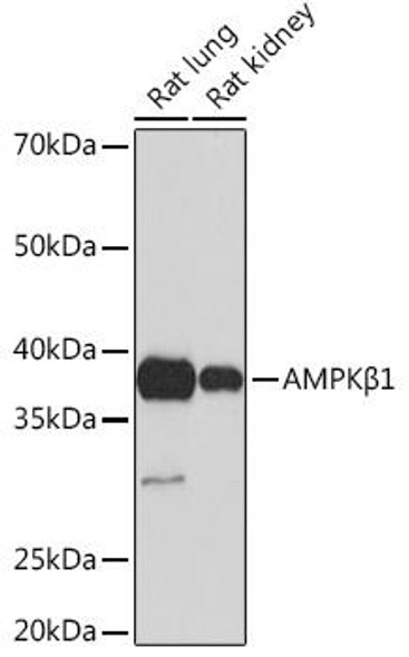 Anti-AMPKBeta1 Antibody (CAB4344)