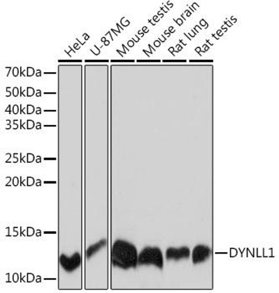 Anti-DYNLL1 Antibody (CAB4353)