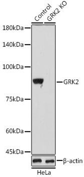 Anti-GRK2 [KO Validated] Antibody (CAB4443)