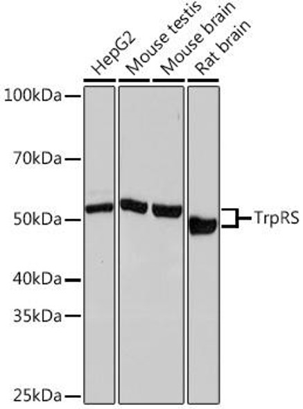 Anti-TrpRS Antibody (CAB4469)