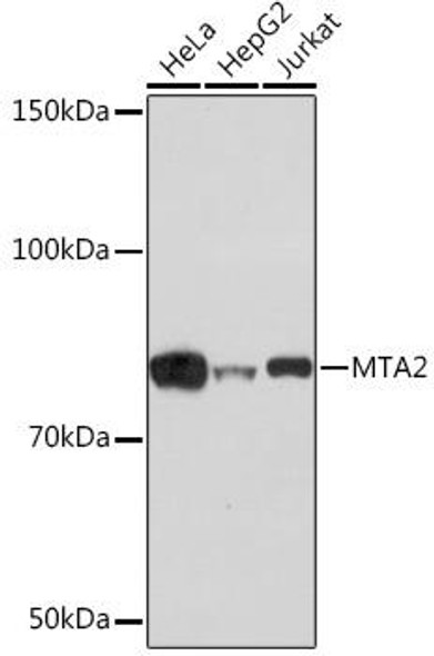 Anti-MTA2 [KO Validated] Antibody (CAB4624)