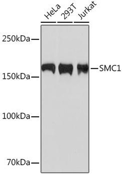 Anti-SMC1 Antibody (CAB4693)