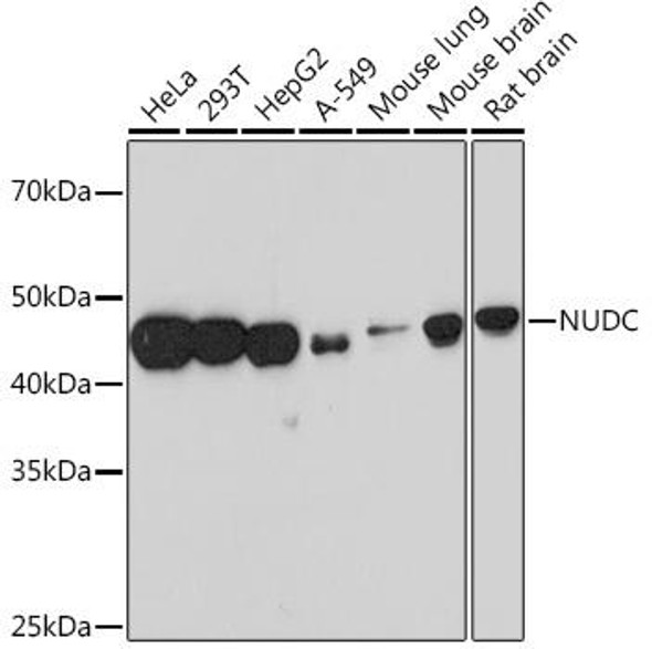 Anti-NUDC Antibody (CAB4719)