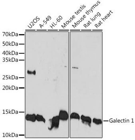Anti-Galectin 1 Antibody (CAB4732)