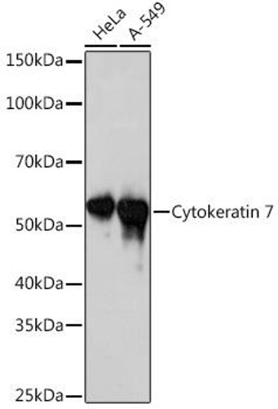 Anti-Cytokeratin 7 Antibody (CAB4765)
