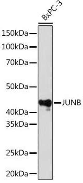 Anti-JunB Antibody (CAB4848)
