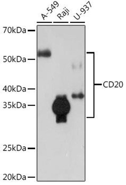 Anti-CD20 Antibody (CAB4893)