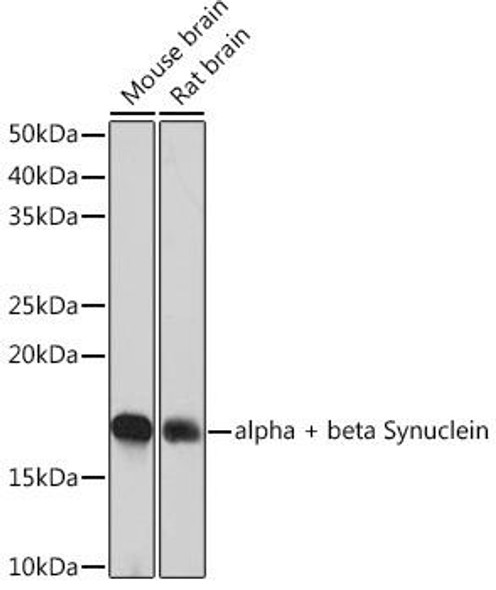 Anti-alpha + beta Synuclein Antibody (CAB4899)