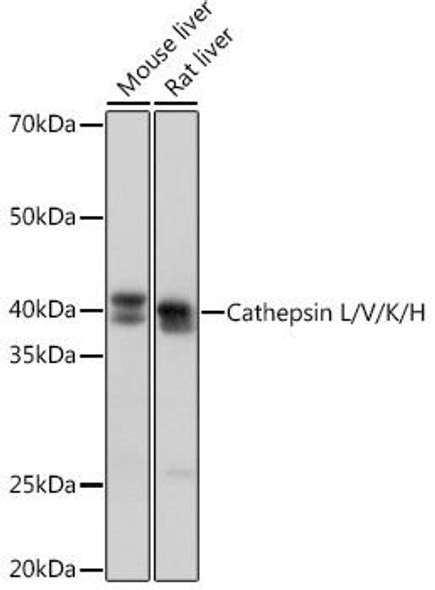 Anti-Cathepsin L/V/K/H Antibody (CAB4986)