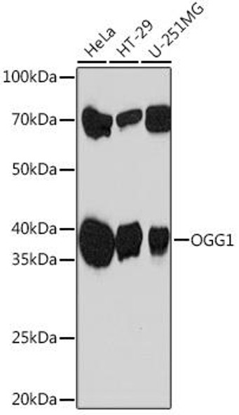 Anti-OGG1 Antibody (CAB4997)