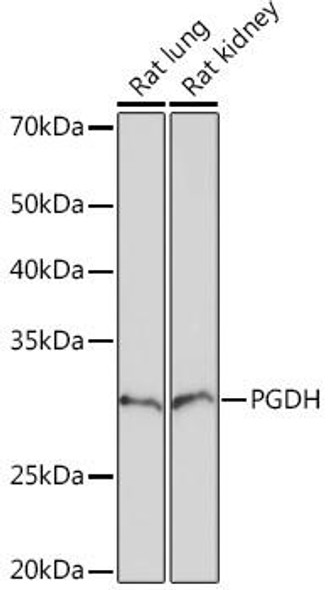 Anti-PGDH Antibody (CAB5024)