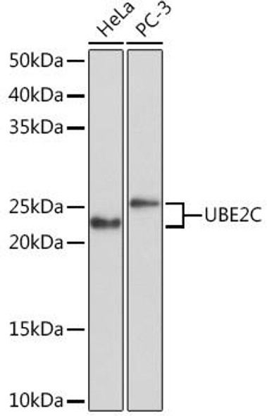 Anti-UBE2C Antibody (CAB5206)