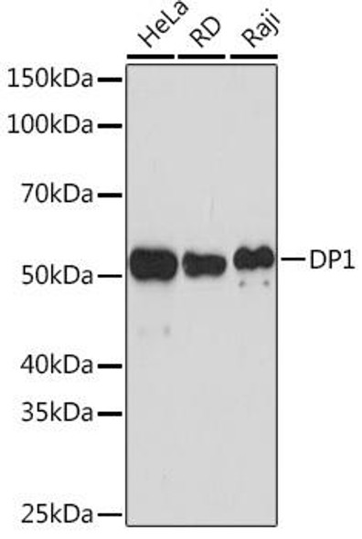 Anti-DP1 Antibody (CAB5214)