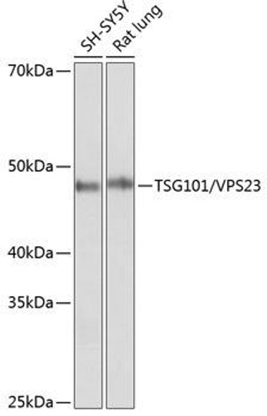 Anti-TSG101 / VPS23 Antibody (CAB5789)